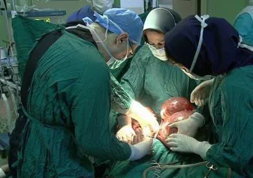 خارج کردن توده 12 کیلویی از شکم بیمار 87 ساله در بیمارستان امیرالمومنین(ع)